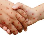 מחלות עור – טיפול חדשני לבעיות בעור